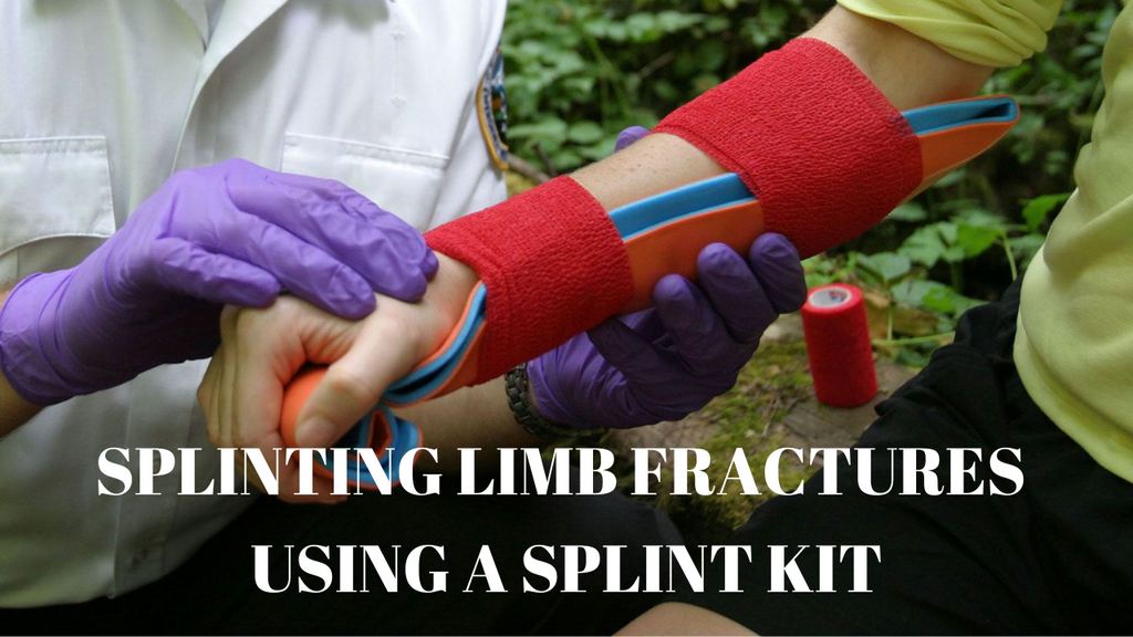 Splinting upper limb fractures using a splint kit