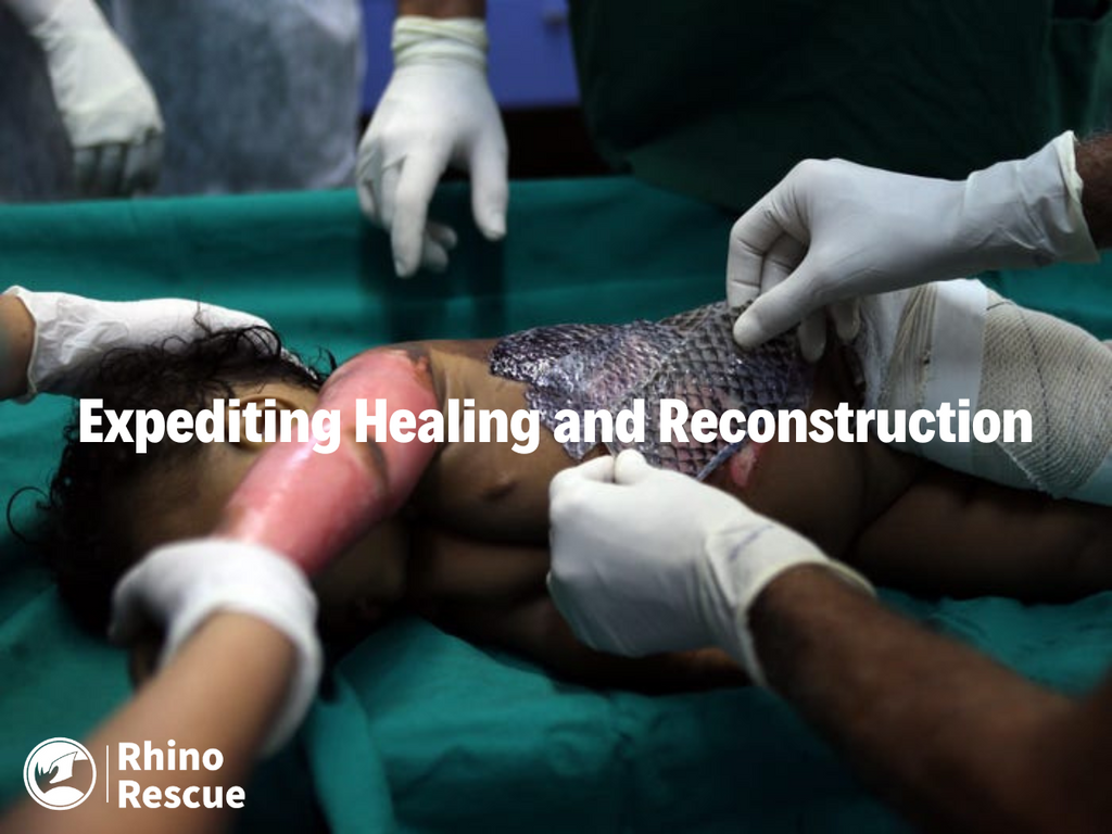 Expediting Healing and Reconstruction: Fish skin grafting in field conditions and in the treatment of burns
