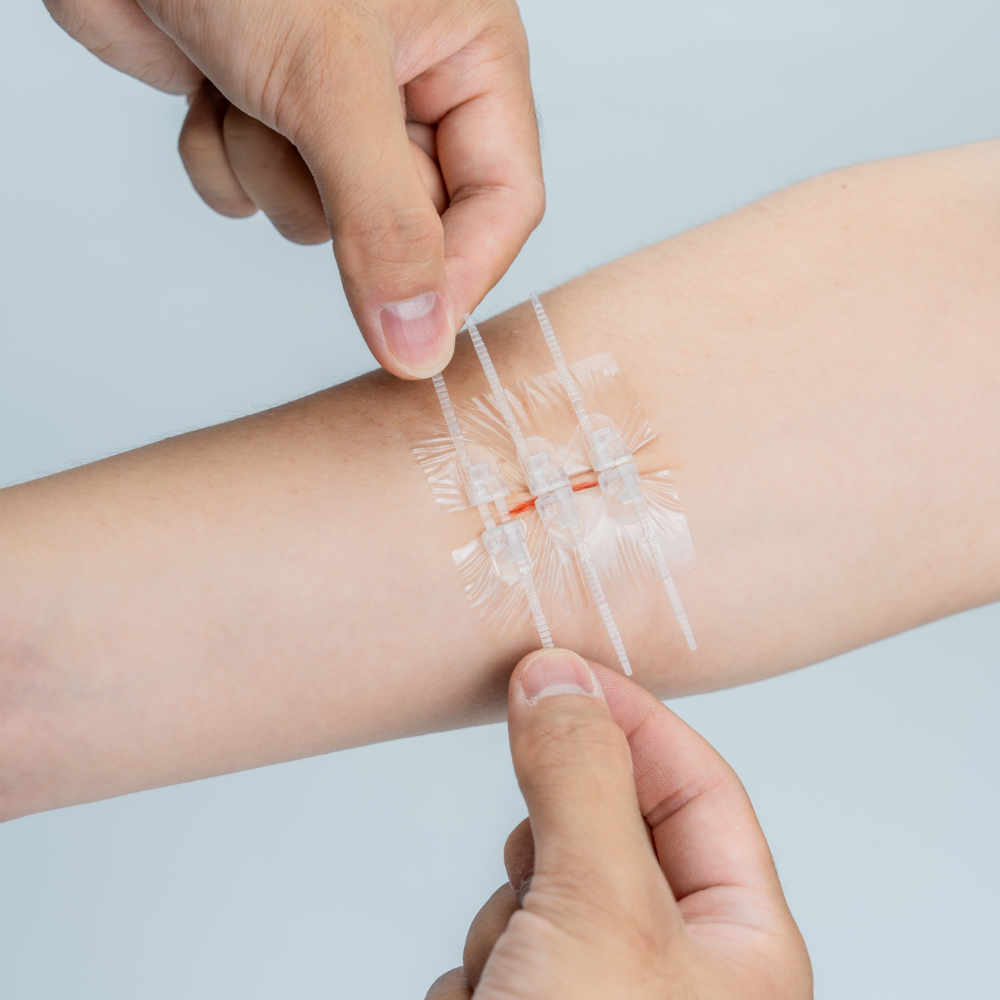 Wound Closure Kit