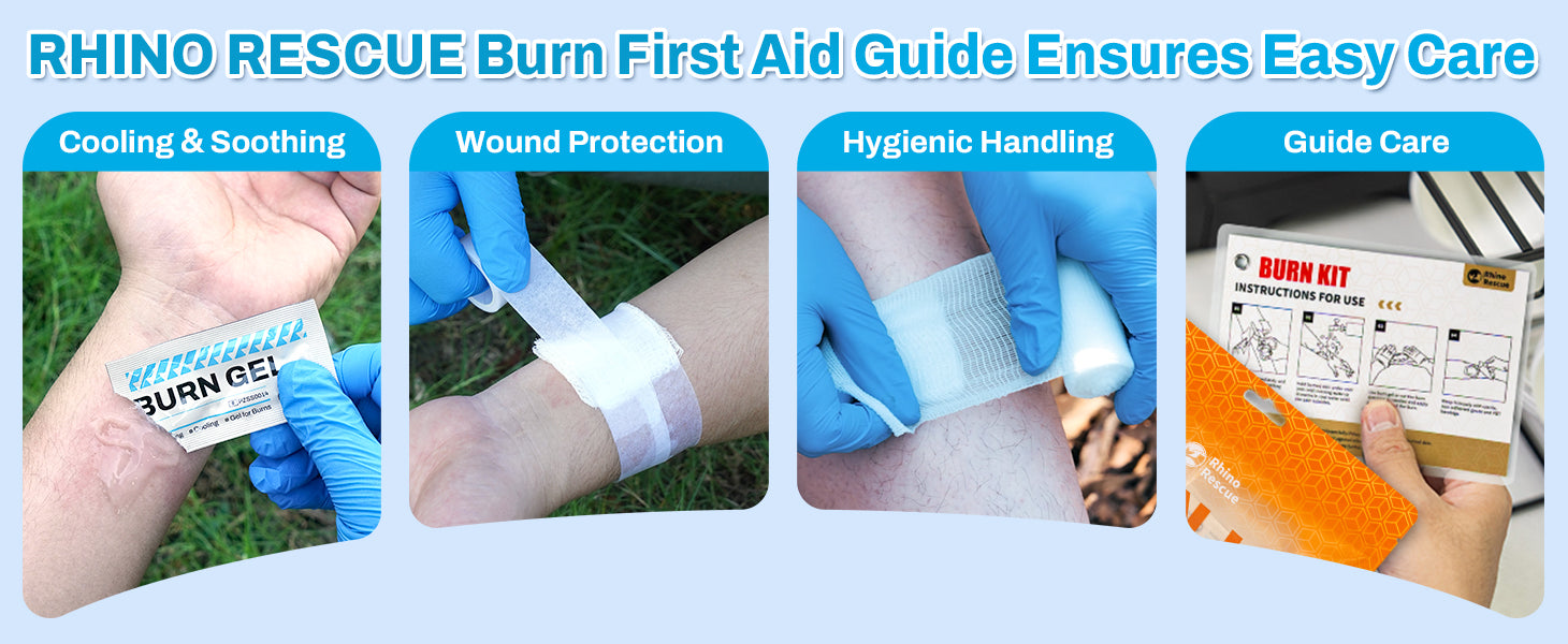 Burn Kit