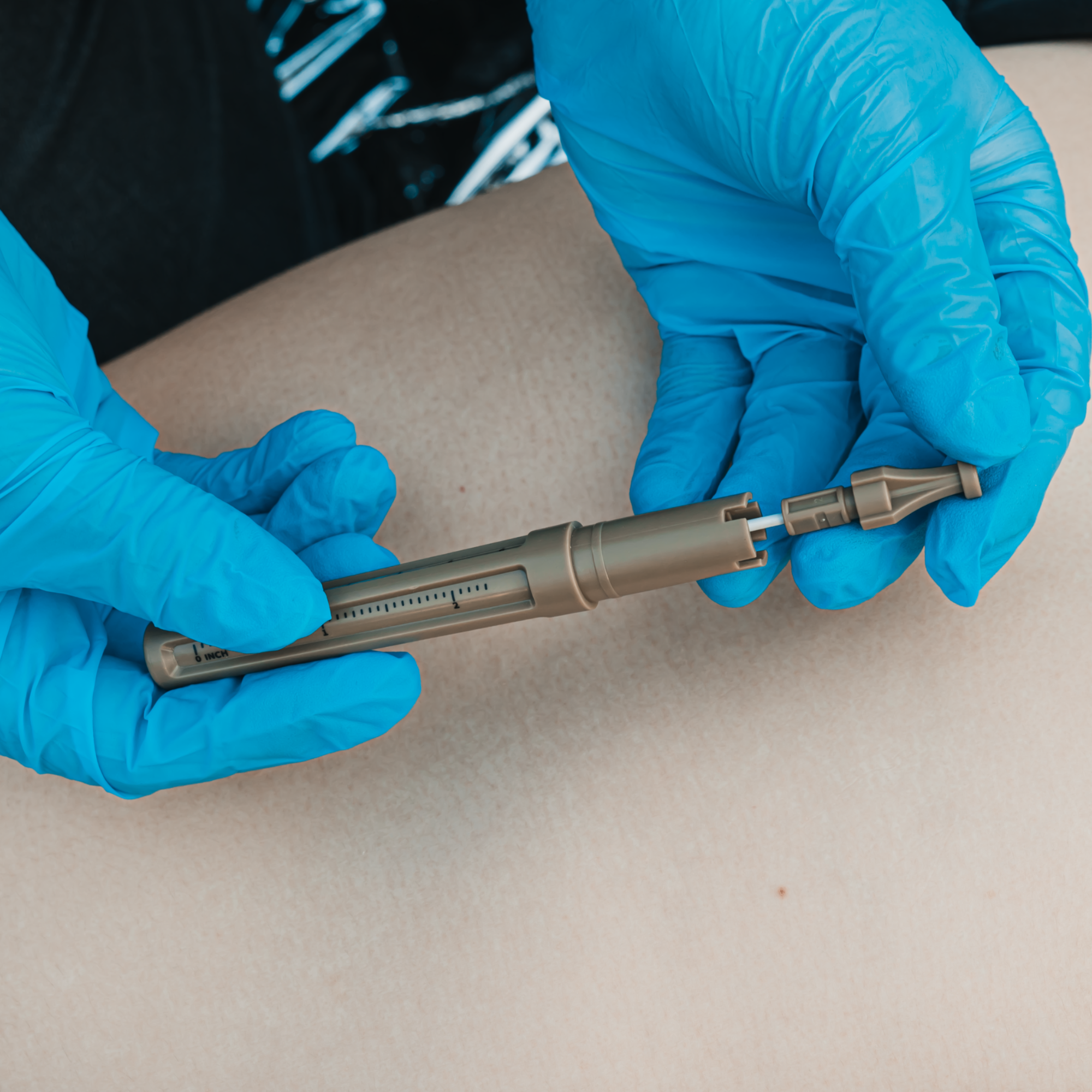 Decompression needle