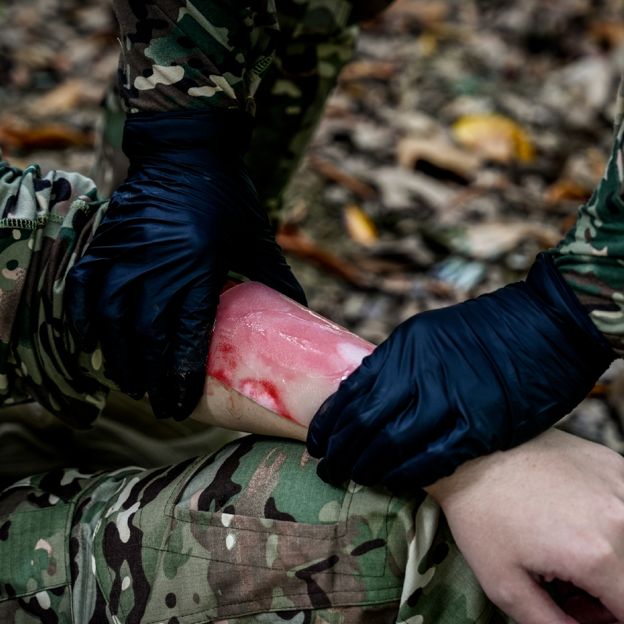 Burn Dressing