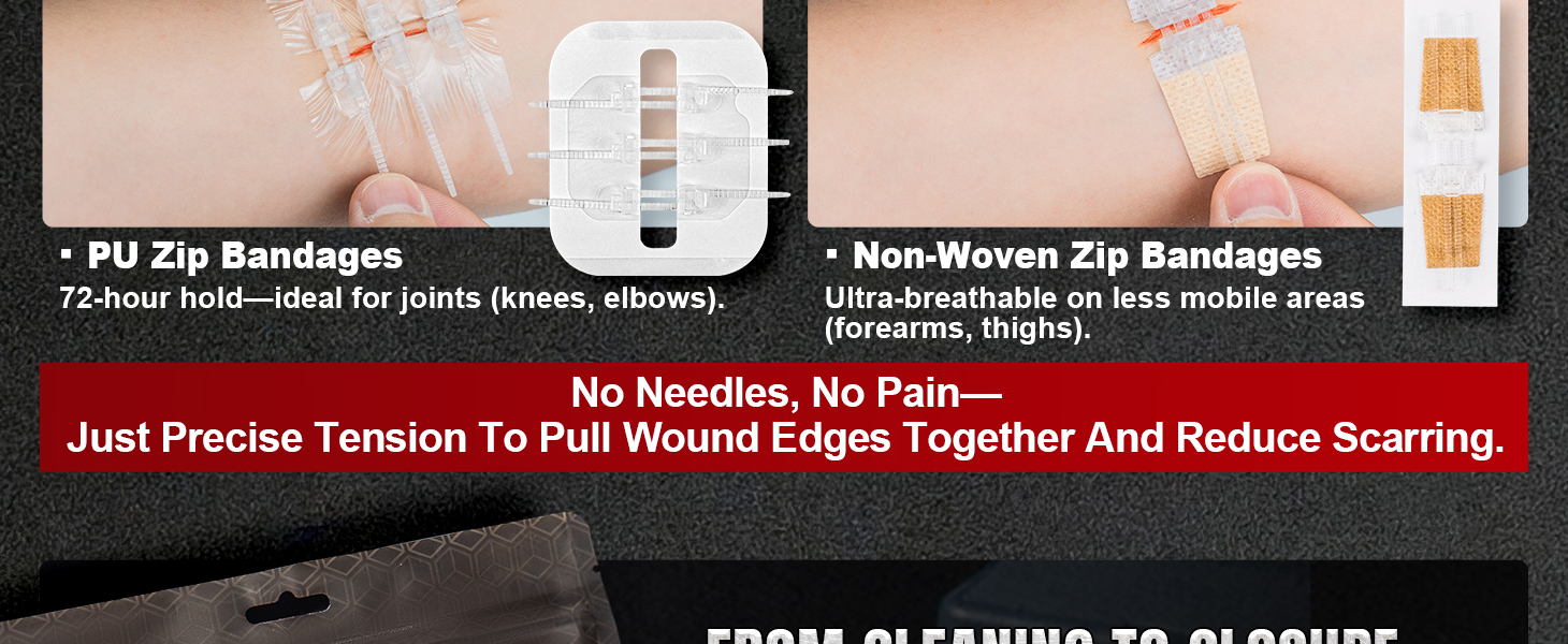 Wound Closure Kit
