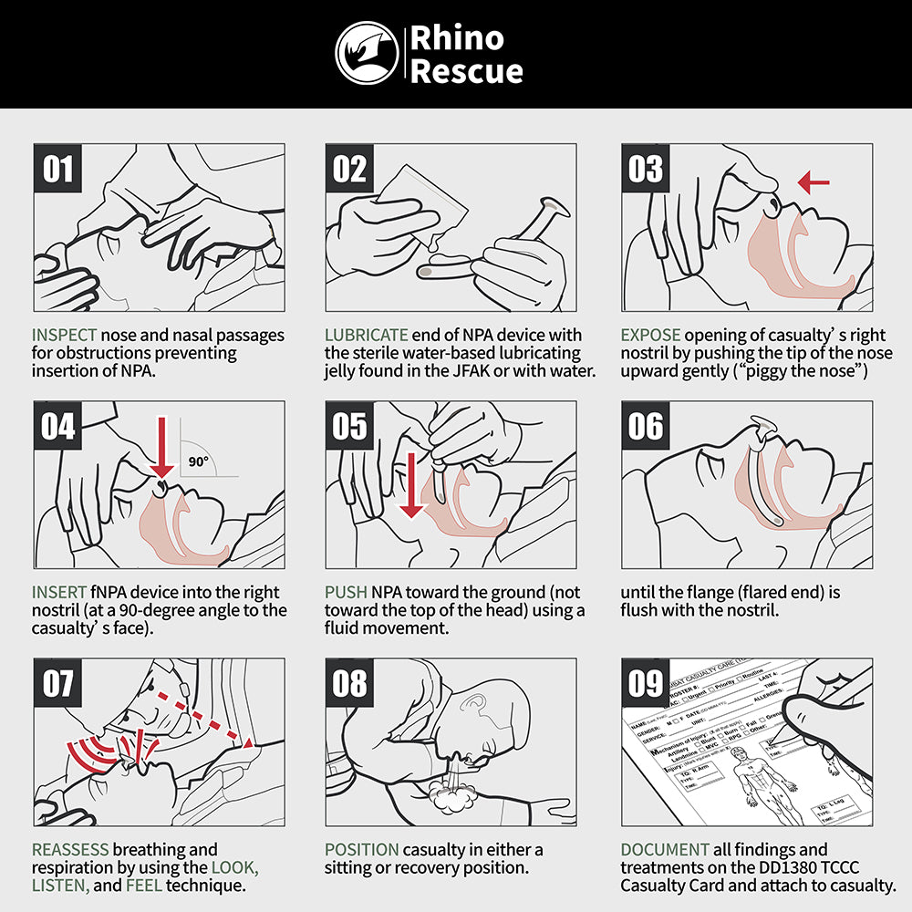 Rhino Nasal Airway